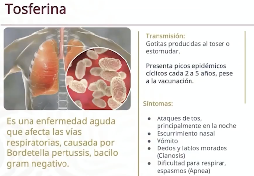 Al alza, casos de tos ferina en SLP